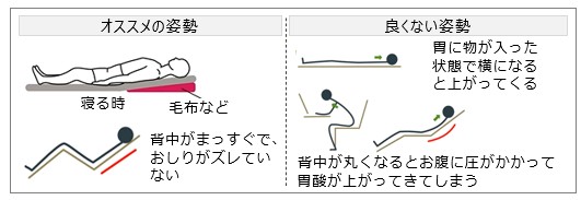 オススメ姿勢・良くない姿勢